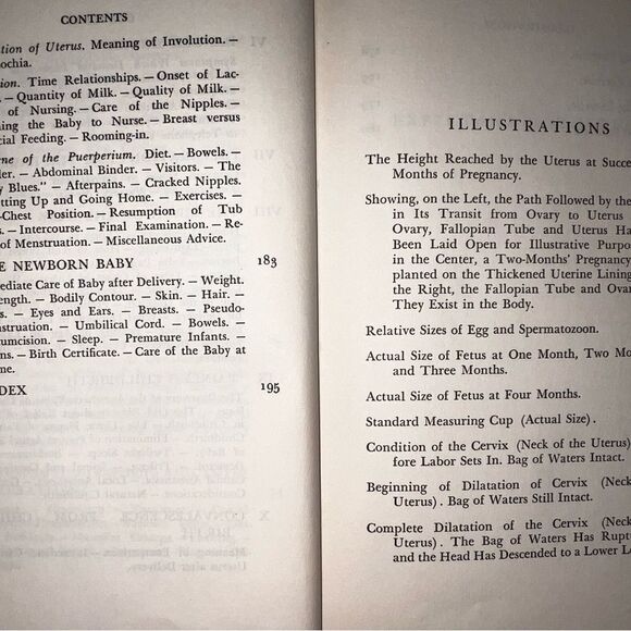 COPY - Expectant Motherhood Book 1957 - Picture 10 of 10